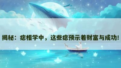 揭秘：痣相学中，这些痣预示着财富与成功！